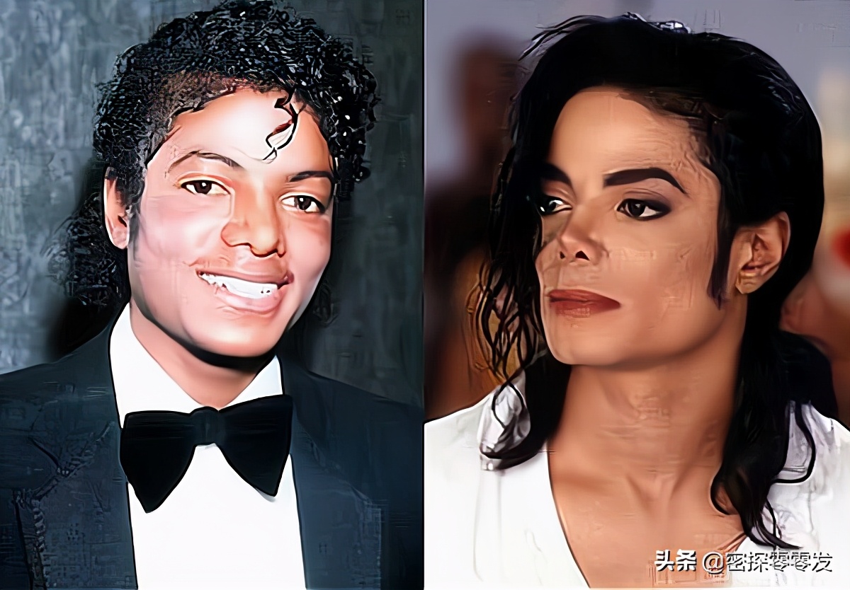 迈克尔杰克逊为什么整容，什么时候开始整容（迈克杰克逊做过哪些整容手术？）